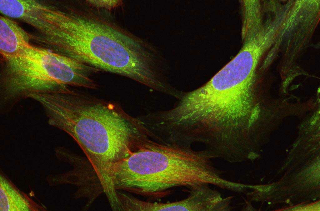 臍帶間充質幹細胞（UCMSC）
