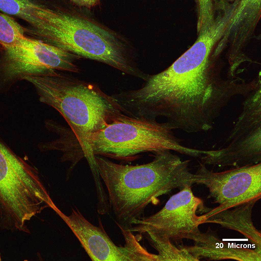 臍帶間充質幹細胞 (UCMSC)